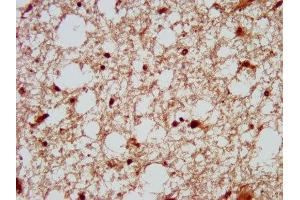 IHC image of ABIN7150649 diluted at 1:200 and staining in paraffin-embedded human brain tissue performed on a Leica BondTM system. (DSCAM anticorps  (AA 1711-1867))