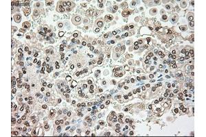 Immunohistochemical staining of paraffin-embedded liver tissue using anti-SERPINA1mouse monoclonal antibody. (SERPINA1 anticorps)