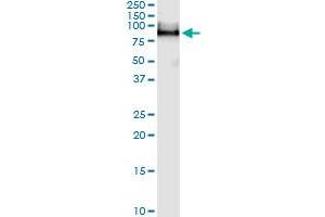 UMOD (Human) IP-WB Antibody Pair