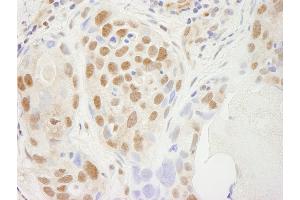Immunohistochemistry (IHC) image for anti-Transcription Elongation Factor SPT5 (SUPT5H) (C-Term) antibody (ABIN7448819) (SUPT5H anticorps  (C-Term))