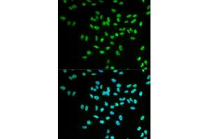 Immunofluorescence analysis of MCF-7 cells using FANCD2 antibody. (FANCD2 anticorps  (AA 1-230))