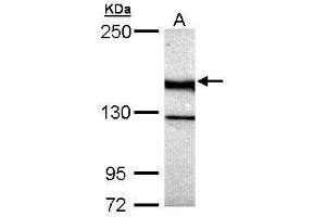 WB Image Sample (30 ug of whole cell lysate) A: Hela 5% SDS PAGE antibody diluted at 1:5000 (UNC13B anticorps  (Center))