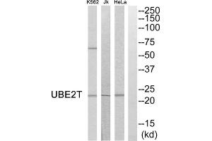 Western blot analysis of extracts from HeLa cells, Jurkat cells and K562 cells, using UBE2T antibody.