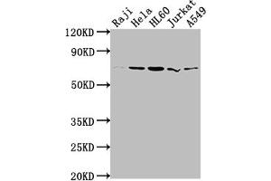 Western Blot Positive WB detected in: Raji whole cell lysate, Hela whole cell lysate, HL60 whole cell lysate, Jurkat whole cell lysate, A549 whole cell lysate All lanes: PRMT5 antibody at 1:2000 Secondary Goat polyclonal to rabbit IgG at 1/50000 dilution Predicted band size: 73, 72, 54, 68, 67 kDa Observed band size: 73 kDa (Recombinant PRMT5 anticorps)