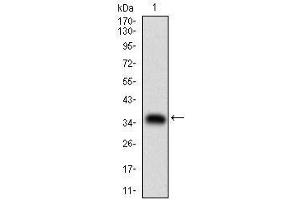 Western blot analysis using ABCB1 mAb against human ABCB1 (AA: 632-693) recombinant protein. (ABCB1 anticorps  (AA 632-693))