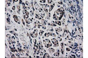 Image no. 3 for anti-Catenin (Cadherin-Associated Protein), beta 1, 88kDa (CTNNB1) antibody (ABIN1496890) (CTNNB1 anticorps)