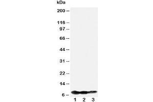 Western blot testing of BAFF-R antibody and Lane 1:  recombinant human protein 10ng;  2: 5ng;  3: 2. (TNFRSF13C anticorps  (N-Term))