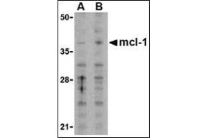 Western blot analysis of Mcl-1in Raji cell lysates with this product at (A) 1 and (B) 2 μg/ml. (MCL-1 anticorps  (N-Term))