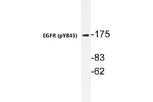 Western blot (WB) analyzes of p-EGFR antibody in extracts from A431 cells. (EGFR anticorps  (pTyr869))