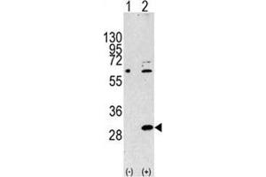 Western blot analysis of EIF4E2 antibody and 293 cell lysate either nontransfected (Lane 1) or transiently transfected with the EIF4E2 gene (2).
