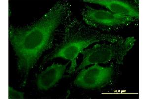 Immunofluorescence of monoclonal antibody to CPA4 on HeLa cell. (CPA4 anticorps  (AA 260-361))