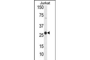 Western blot analysis of C Antibody (Center) (ABIN653826 and ABIN2843094) in Jurkat cell line lysates (35 μg/lane). (CD160 anticorps  (AA 56-82))