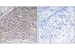 Immunohistochemistry analysis of paraffin-embedded human testis tissue, using MAST4 Antibody. (MAST4 anticorps  (AA 251-300))
