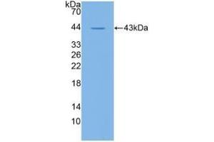 Detection of Recombinant CD19, Human using Polyclonal Antibody to Cluster Of Differentiation 19 (CD19) (CD19 anticorps  (AA 160-258))