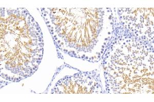 Detection of HSPA1L in Rat Testis Tissue using Polyclonal Antibody to Heat Shock 70 kDa Protein 1 Like Protein (HSPA1L) (HSPA1L anticorps  (AA 1-641))