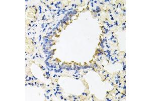 Immunohistochemistry of paraffin-embedded rat lung using CALU antibody (ABIN6129533, ABIN6137878, ABIN6137880 and ABIN6222201) at dilution of 1:100 (40x lens).