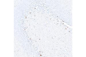 Immunohistochemistry (IHC) image for anti-Achaete-Scute Complex Homolog 1 (Drosophila) (ASCL1) (AA 186-236) antibody (ABIN7455113) (Recombinant ASCL1 anticorps  (AA 186-236))