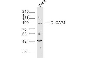 DLGAP4 anticorps  (AA 261-370)