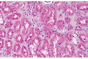 Human Kidney: Formalin-Fixed, Paraffin-Embedded (FFPE) (CRLS1 anticorps  (AA 161-174))