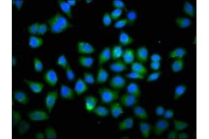 Immunofluorescence staining of Hela cells with ABIN7149579 at 1:66, counter-stained with DAPI. (DOCK1 anticorps  (AA 1676-1865))