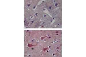 Immunohistochemical analysis of TLR8 in paraffin-embedded formalin-fixed human brain tissue using an isotype control (top) and TLR8 monoclonal antibody, clone 44C143  (bottom) at 5 ug/mL . (TLR8 anticorps  (AA 750-850))