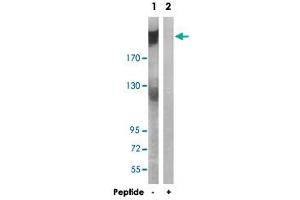 Western blot analysis of extracts from A-549 cells, using ARFGEF2 polyclonal antibody . (ARFGEF2 anticorps)
