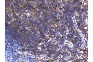 Image no. 1 for anti-Asialoglycoprotein Receptor 2 (ASGR2) antibody (ABIN1496744)