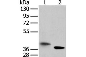 Western blot analysis of A172 cell and mouse kidney tissue using LRRC19 Polyclonal Antibody at dilution of 1:450 (LRRC19 anticorps)