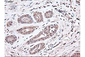 Immunohistochemical staining of paraffin-embedded breast using anti-Trim33 (ABIN2452535) mouse monoclonal antibody. (TRIM33 anticorps  (AA 887-1046))