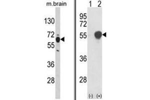 (LEFT) Western blot analysis of PHGDH Antibody (N-term) in mouse brain tissue lysates (35ug/lane). (PHGDH anticorps  (N-Term))