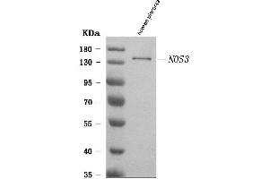 Western blot analysis of eNOS/NOS3 using anti-eNOS/NOS3 antibody (ABIN7601375).