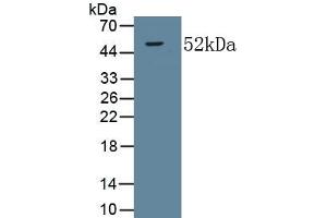 Detection of Recombinant COL5a2, Human using Monoclonal Antibody to Collagen Type V Alpha 2 (COL5a2) (COL5A2 anticorps  (AA 82-308))