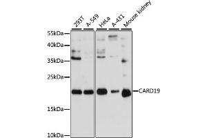 Western blot analysis of extracts of various cell lines, using C antibody (ABIN6127784, ABIN6137941, ABIN6137942 and ABIN6217103) at 1:3000 dilution. (C9orf89 anticorps  (AA 1-100))