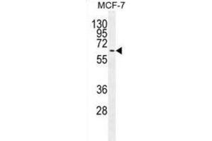 Western Blotting (WB) image for anti-Mitogen-Activated Protein Kinase 15 (MAPK15) antibody (ABIN2995325) (MAPK15 anticorps)