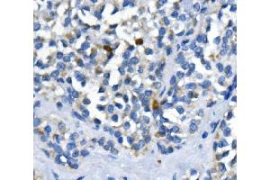 IHC analysis of PPM1A using anti-PPM1A antibody (ABIN7603116).