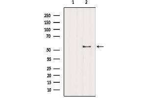 Western blot analysis of extracts from B16F10, using ZNF497 Antibody. (ZNF497 anticorps)