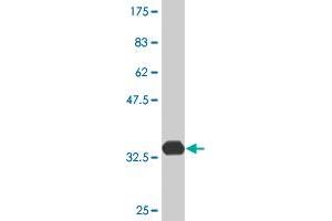 Western Blot detection against Immunogen (33. (ATOX1 anticorps  (AA 1-68))