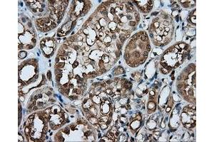 Immunohistochemical staining of paraffin-embedded liver tissue using anti-PPP5C mouse monoclonal antibody. (PP5 anticorps)