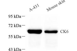 Western blot analysis of CK6 (ABIN7074423) at dilution of 1: 1000 (Keratin 6 anticorps)