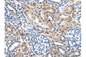 SLC22A3 antibody was used for immunohistochemistry at a concentration of 4-8 ug/ml to stain Epithelial cells of renal tubule (arrows) in Human Kidney.