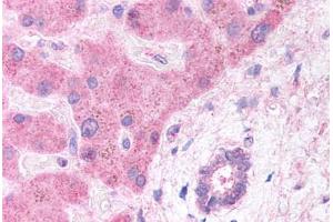 Human Hepatocytes and Bile Duct (formalin-fixed, paraffin-embedded) stained with LRP6 antibody ABIN291653 at 5 ug/ml followed by biotinylated anti-goat IgG secondary antibody ABIN481715, alkaline phosphatase-streptavidin and chromogen. (LRP6 anticorps  (AA 1547-1560))