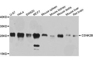 Western blot analysis of extracts of various cells, using CSNK2B antibody. (CSNK2B anticorps)