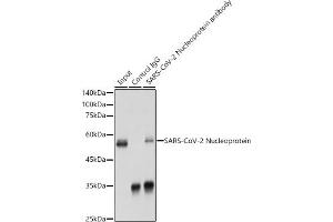 Immunoprecipitation analysis of 300 μg extracts of 293T cells using 3 μg SARS-CoV-2 Nucleoprotein antibody (ABIN7269053). (Nucleoprotein anticorps)