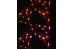 anti-Breast Cancer Metastasis Suppressor 1 (BRMS1) (AA 90-210) antibody