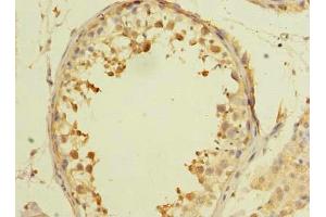 Immunohistochemistry of paraffin-embedded human testis tissue using ABIN7143633 at dilution of 1:100 (AARSD1 anticorps  (AA 1-230))