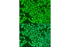 Immunofluorescence analysis of U2OS cells using HIF1A antibody (ABIN2736893) at dilution of 1:100. (HIF1A anticorps)
