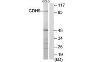 Western blot analysis of extracts from COLO cells, using CDH9 Antibody. (Cadherin 9 anticorps  (AA 201-250))