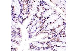 Immunohistochemistry of paraffin embedded mouse colon using ZKSCAN4 (ABIN7076265) at dilution of 1:1300 (400x lens)