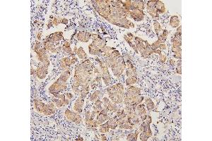 IHC analysis of PYROXD1 using anti-PYROXD1 antibody (ABIN6719650). (PYROXD1 anticorps  (AA 48-230))