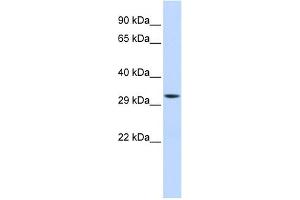 WB Suggested Anti-MTIF3 Antibody Titration: 0. (MTIF3 anticorps  (Middle Region))
